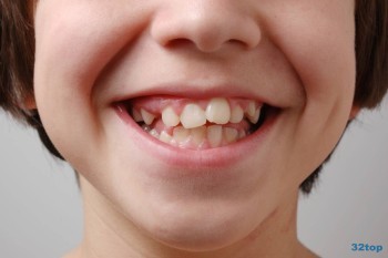 Правило генерации страниц